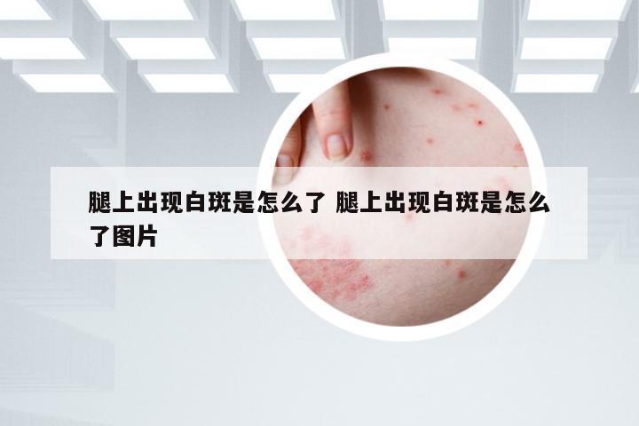 腿上出现白斑是怎么了 腿上出现白斑是怎么了图片