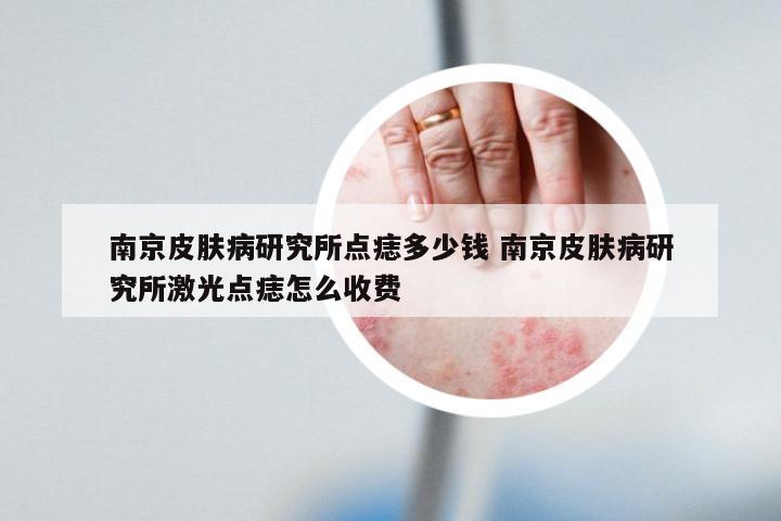 南京皮肤病研究所点痣多少钱 南京皮肤病研究所激光点痣怎么收费