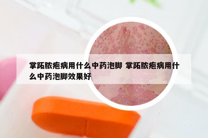 掌跖脓疱病用什么中药泡脚 掌跖脓疱病用什么中药泡脚效果好