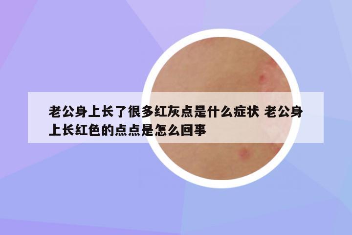 老公身上长了很多红灰点是什么症状 老公身上长红色的点点是怎么回事