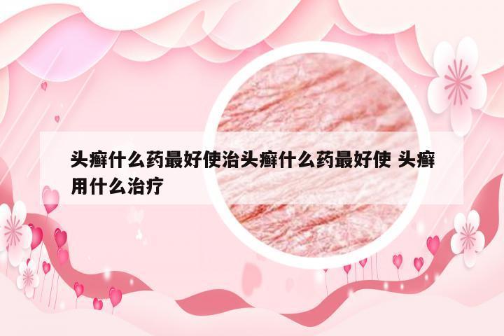 头癣什么药最好使治头癣什么药最好使 头癣用什么治疗