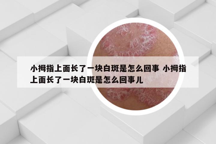 小拇指上面长了一块白斑是怎么回事 小拇指上面长了一块白斑是怎么回事儿