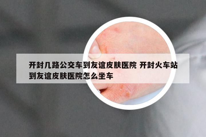 开封几路公交车到友谊皮肤医院 开封火车站到友谊皮肤医院怎么坐车