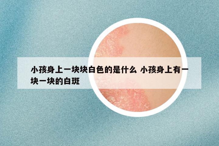 小孩身上一块块白色的是什么 小孩身上有一块一块的白斑