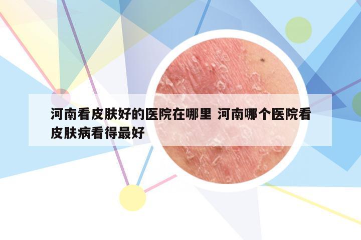 河南看皮肤好的医院在哪里 河南哪个医院看皮肤病看得最好