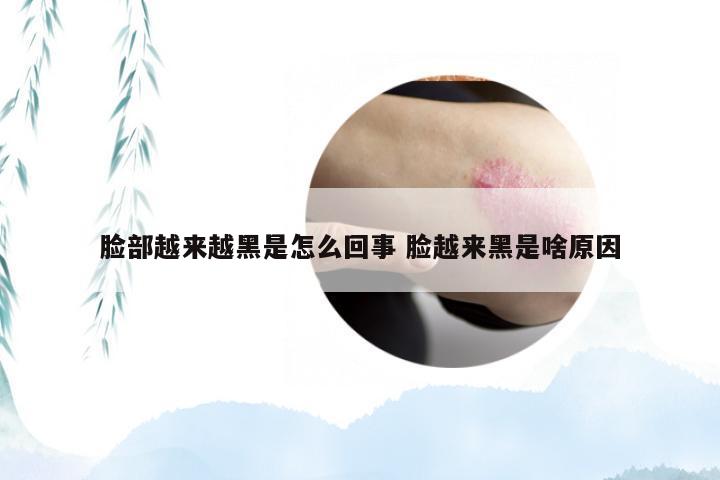 脸部越来越黑是怎么回事 脸越来黑是啥原因