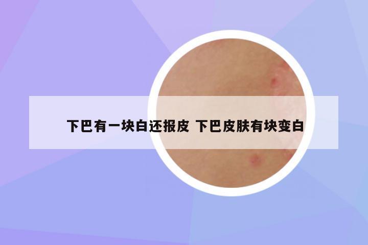 下巴有一块白还报皮 下巴皮肤有块变白