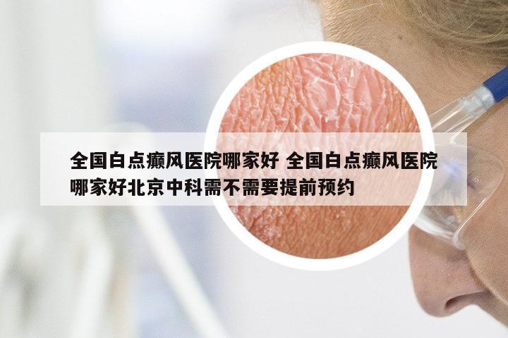 全国白点癫风医院哪家好 全国白点癫风医院哪家好北京中科需不需要提前预约