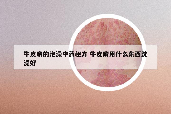 牛皮廨的泡澡中药秘方 牛皮廨用什么东西洗澡好