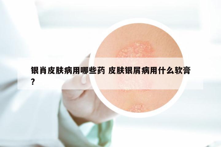 银肖皮肤病用哪些药 皮肤银屑病用什么软膏?