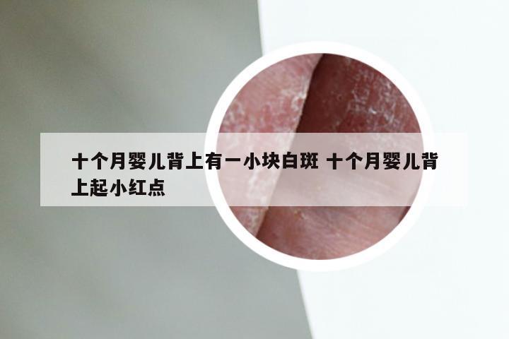 十个月婴儿背上有一小块白斑 十个月婴儿背上起小红点