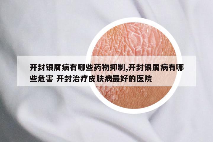 开封银屑病有哪些药物抑制,开封银屑病有哪些危害 开封治疗皮肤病最好的医院