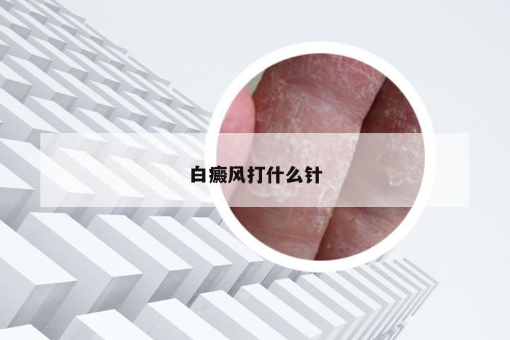 白癜风打什么针