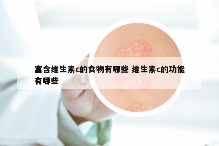 富含维生素c的食物有哪些 维生素c的功能有哪些