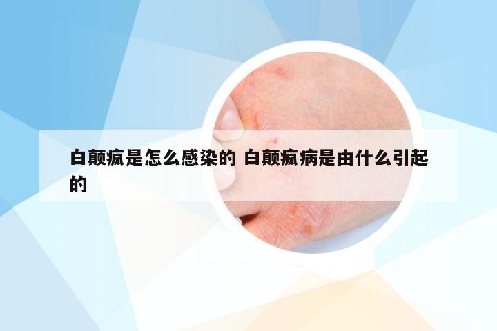 白颠疯是怎么感染的 白颠疯病是由什么引起的