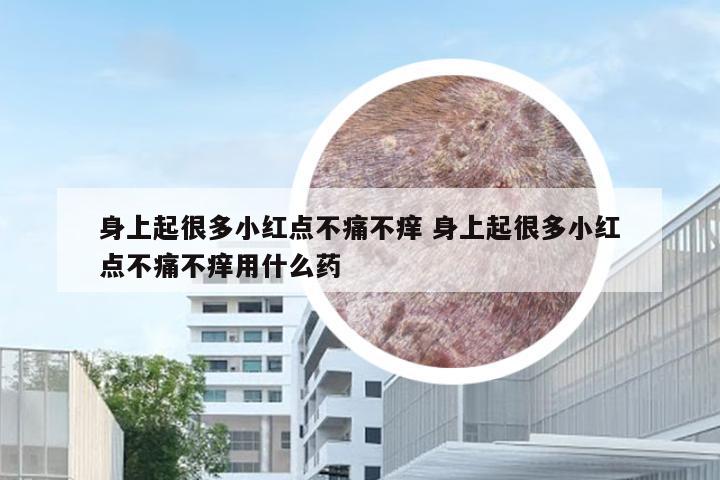 身上起很多小红点不痛不痒 身上起很多小红点不痛不痒用什么药