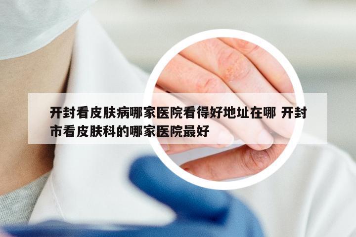 开封看皮肤病哪家医院看得好地址在哪 开封市看皮肤科的哪家医院最好