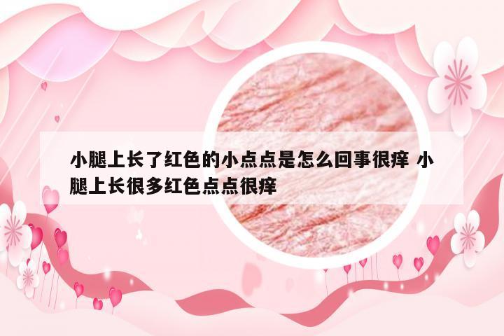 小腿上长了红色的小点点是怎么回事很痒 小腿上长很多红色点点很痒