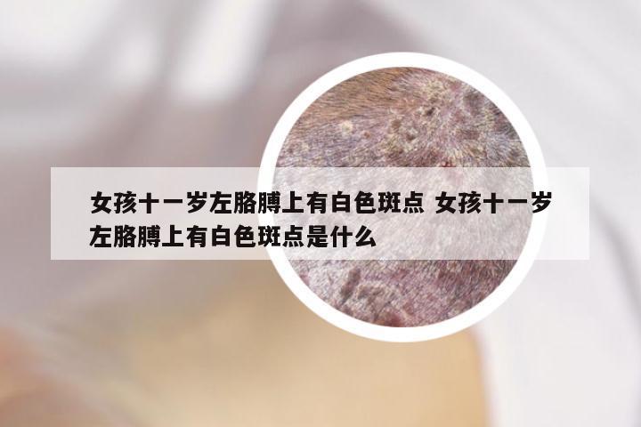 女孩十一岁左胳膊上有白色斑点 女孩十一岁左胳膊上有白色斑点是什么