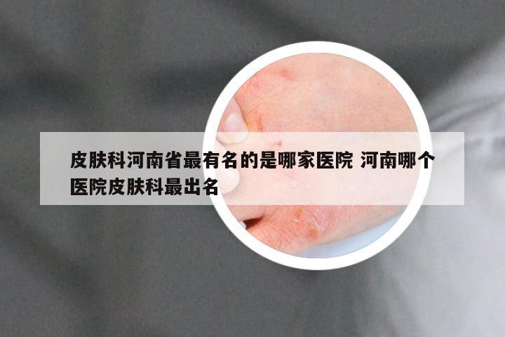 皮肤科河南省最有名的是哪家医院 河南哪个医院皮肤科最出名