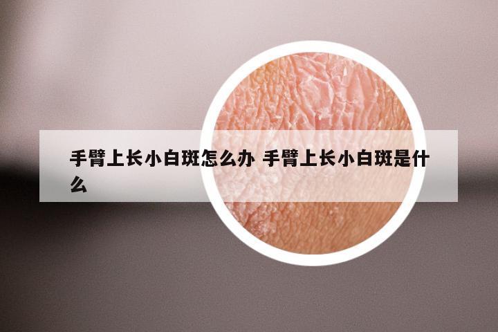 手臂上长小白斑怎么办 手臂上长小白斑是什么
