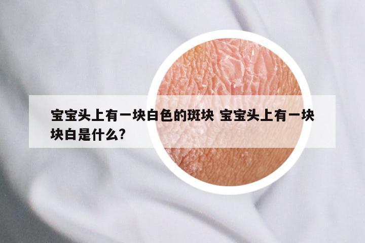 宝宝头上有一块白色的斑块 宝宝头上有一块块白是什么?