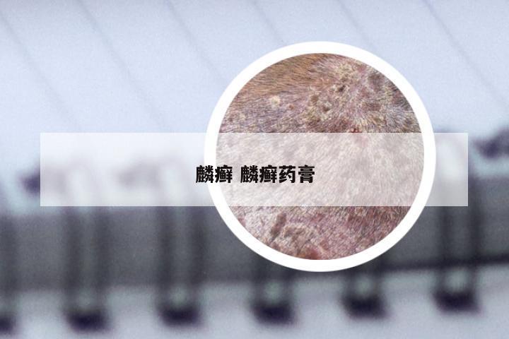 麟癣 麟癣药膏