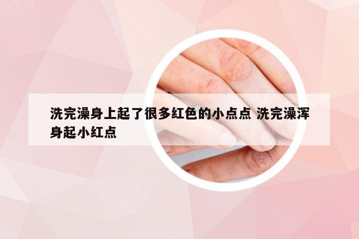 洗完澡身上起了很多红色的小点点 洗完澡浑身起小红点