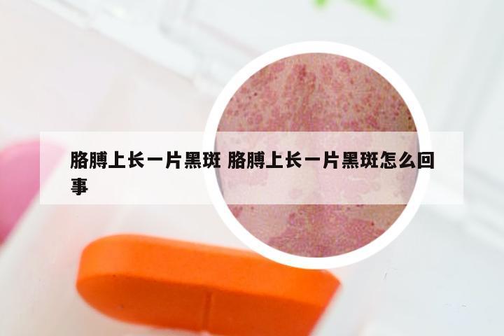 胳膊上长一片黑斑 胳膊上长一片黑斑怎么回事