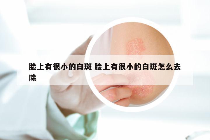 脸上有很小的白斑 脸上有很小的白斑怎么去除