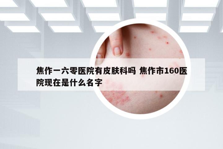 焦作一六零医院有皮肤科吗 焦作市160医院现在是什么名字