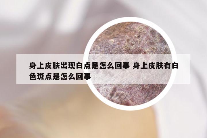 身上皮肤出现白点是怎么回事 身上皮肤有白色斑点是怎么回事