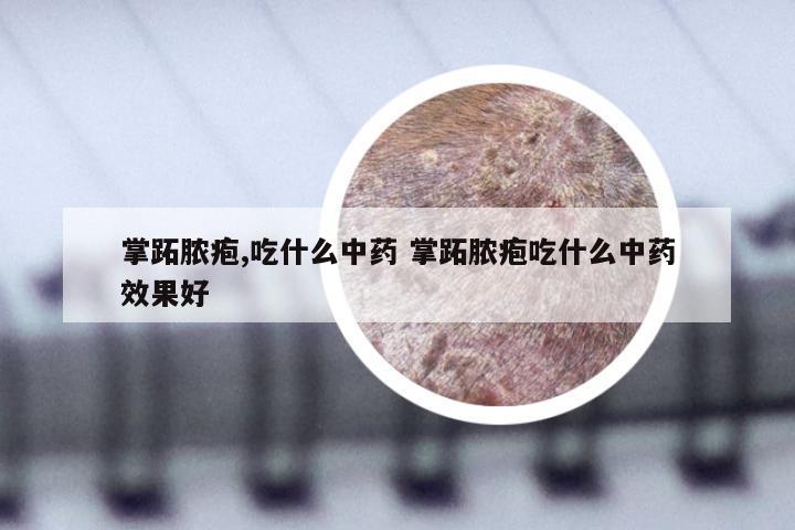 掌跖脓疱,吃什么中药 掌跖脓疱吃什么中药效果好