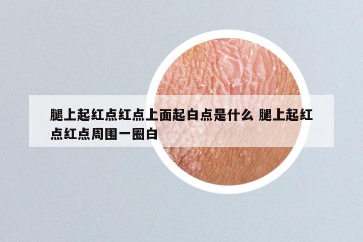 腿上起红点红点上面起白点是什么 腿上起红点红点周围一圈白