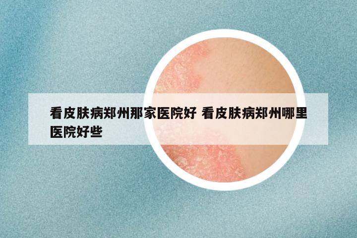 看皮肤病郑州那家医院好 看皮肤病郑州哪里医院好些