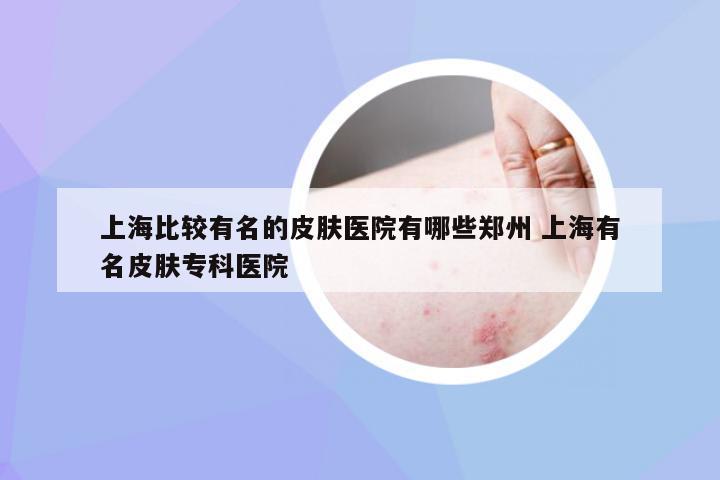上海比较有名的皮肤医院有哪些郑州 上海有名皮肤专科医院