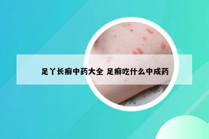 足丫长癣中药大全 足癣吃什么中成药