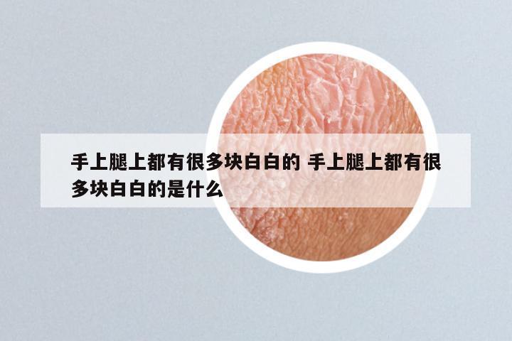 手上腿上都有很多块白白的 手上腿上都有很多块白白的是什么