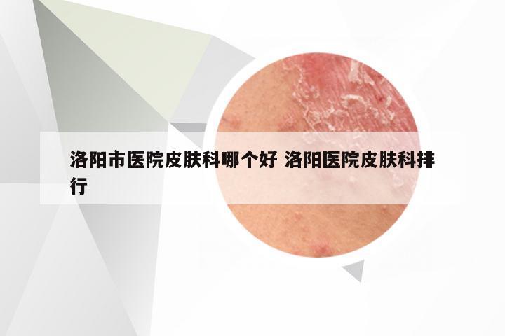 洛阳市医院皮肤科哪个好 洛阳医院皮肤科排行
