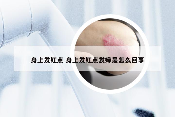 身上发红点 身上发红点发痒是怎么回事