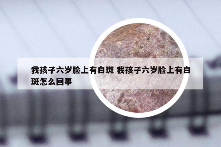 我孩子六岁脸上有白斑 我孩子六岁脸上有白斑怎么回事