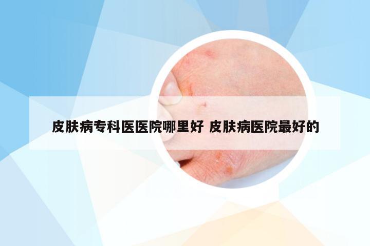 皮肤病专科医医院哪里好 皮肤病医院最好的