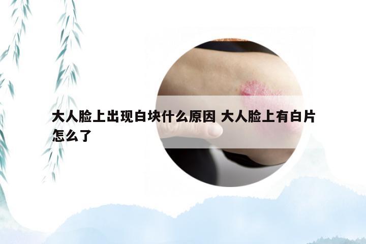 大人脸上出现白块什么原因 大人脸上有白片怎么了