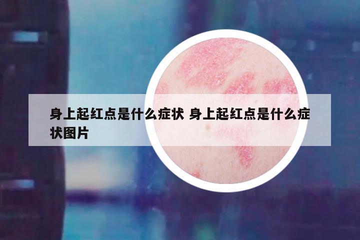 身上起红点是什么症状 身上起红点是什么症状图片