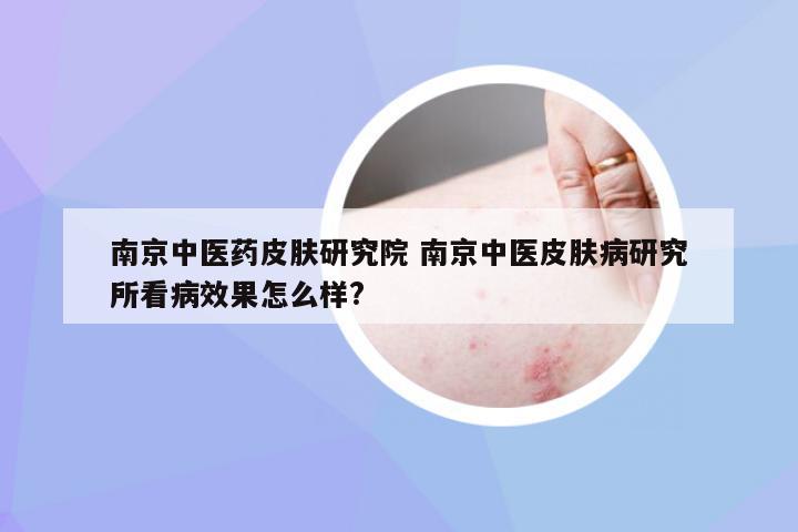 南京中医药皮肤研究院 南京中医皮肤病研究所看病效果怎么样?