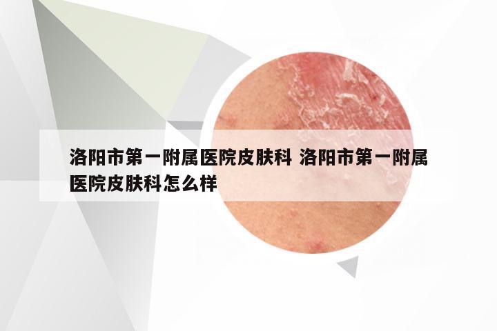 洛阳市第一附属医院皮肤科 洛阳市第一附属医院皮肤科怎么样