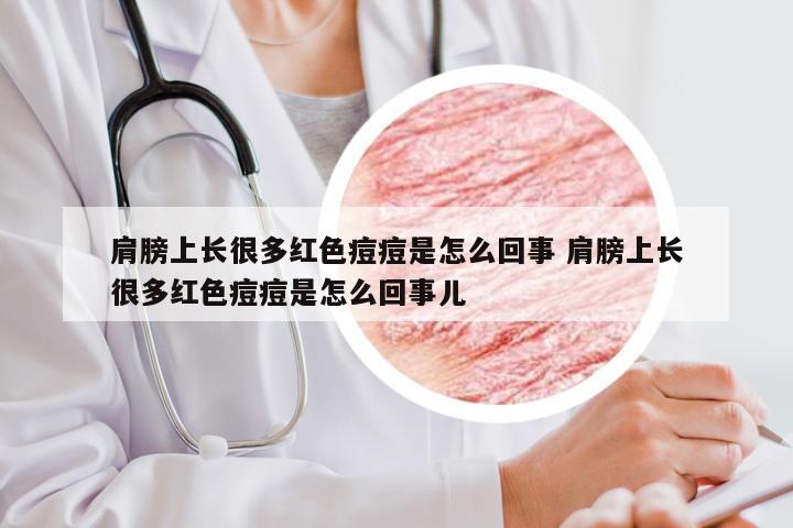 肩膀上长很多红色痘痘是怎么回事 肩膀上长很多红色痘痘是怎么回事儿