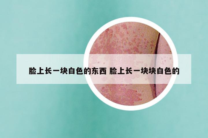 脸上长一块白色的东西 脸上长一块块白色的