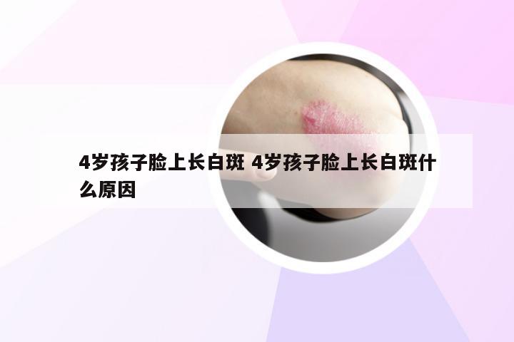 4岁孩子脸上长白斑 4岁孩子脸上长白斑什么原因