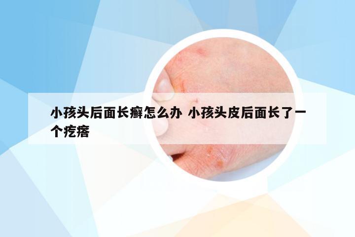 小孩头后面长癣怎么办 小孩头皮后面长了一个疙瘩